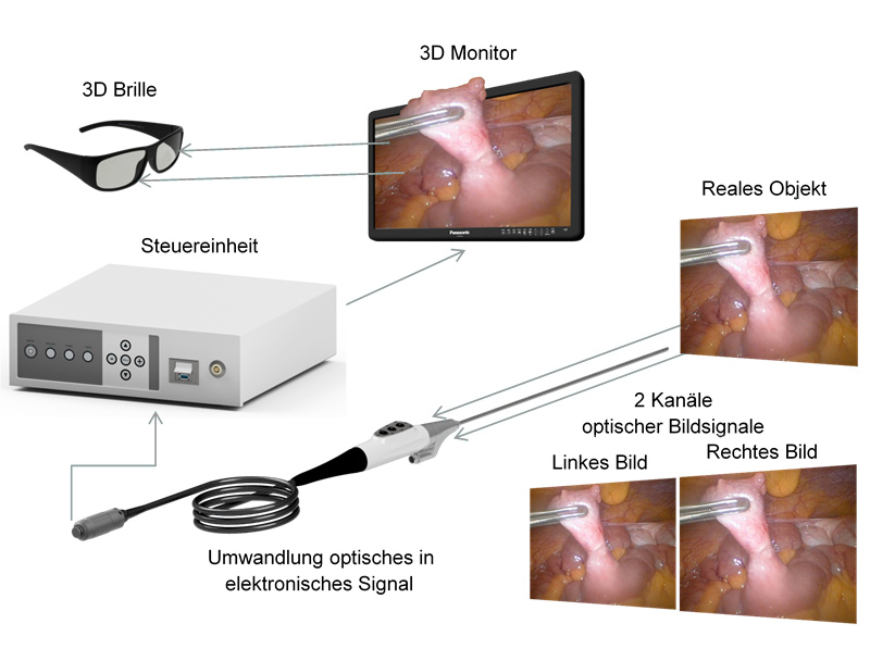 BMTvision 3D Stereoskopie